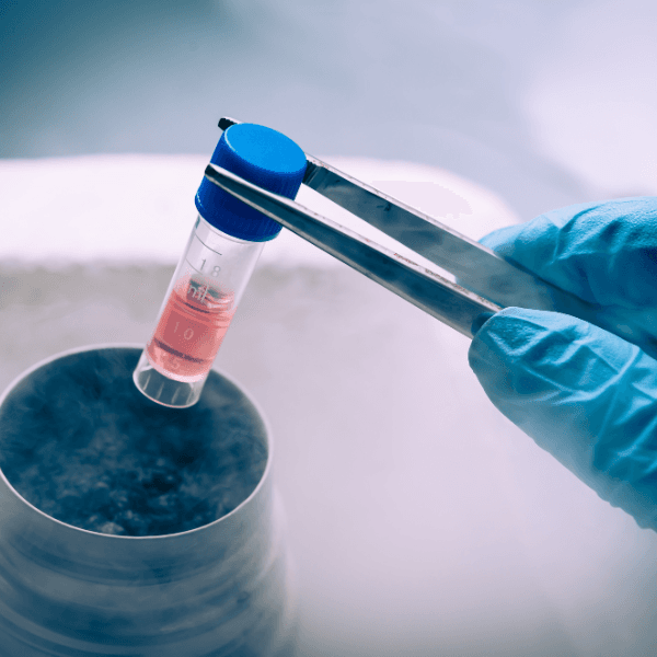 Stem cell therapy for generalized arthritis